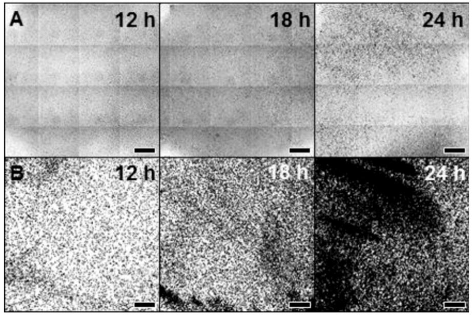 應(yīng)用細(xì)胞成像分析裝置評價黃芩甙元、殼聚糖和念珠菌和地衣酸對假絲酵母菌和克魯斯假絲酵母菌中生物膜的影響