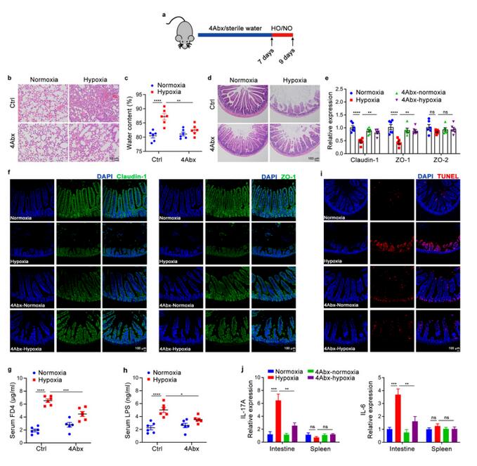 腸道微生物群的磷脂代謝產(chǎn)物可促進(jìn)缺氧誘導(dǎo)的腸道損傷