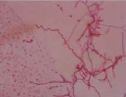 Act0988放線菌拮抗菌株的鑒定、培養(yǎng)條件與菌株生長關系、發(fā)酵工藝（一）