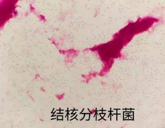 分枝桿菌在貓、狗、鳥(niǎo)中的流行和傳播途徑