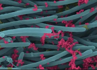 基于低生物量微生物富集方法觀察ICU患者下呼吸道微生物組的功能和進(jìn)化動(dòng)態(tài)