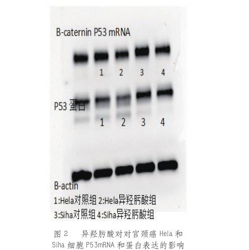 新型靶向抗癌藥HDAC抑制劑可誘導(dǎo)腫瘤細(xì)胞分化、選擇性凋亡——結(jié)果與討論