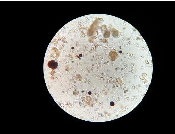 益生菌靶向腸道微生物群，改善血腦屏障及其相關(guān)疾病的研究（三）