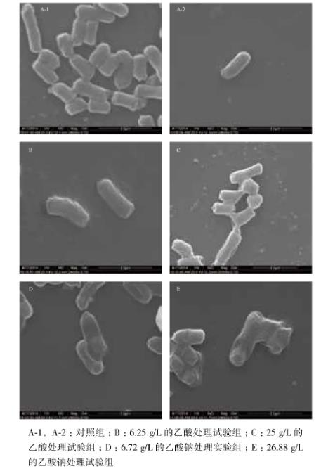 高密度發(fā)酵的過(guò)程中乙酸抑制重組大腸桿菌生長(zhǎng)及外源基因的表達(dá)——材料與方法