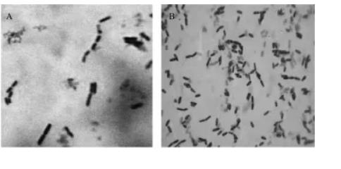 枯草芽孢桿菌LBD-1形態(tài)特征、生長曲線、抗逆性及發(fā)酵后飼料特性（一）