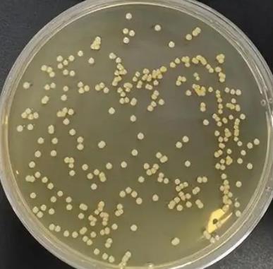 什么是球菌感染？疑似球菌1000多是怎么回事？球菌會(huì)傳染人嗎