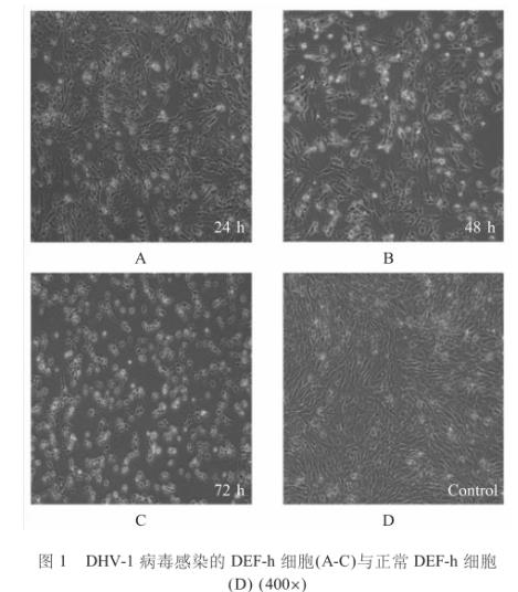 鴨胚成纖維細(xì)胞培養(yǎng)I型鴨病毒性肝炎并繪制一步生長(zhǎng)曲線——材料與方法