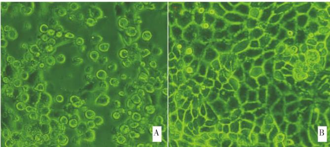 豬傳染性胃腸炎病毒TGEV一步生長曲線繪制
