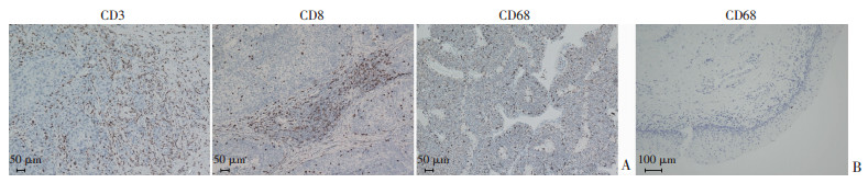 CLDN10信號通路對膀胱癌細(xì)胞生長和增殖的作用（一）