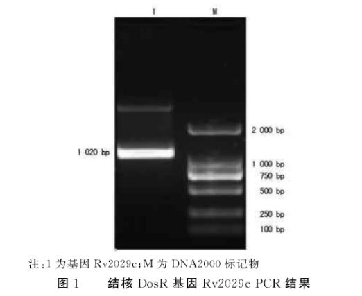 結(jié)核分枝桿菌蛋白R(shí)v2029c促進(jìn)大腸埃希菌生長(zhǎng)及糖酵解能力——摘要、材料與方法