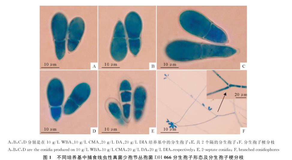 捕食線蟲(chóng)性真菌少孢節(jié)叢孢菌不同分離株在4種培養(yǎng)基的生長(zhǎng)速度研究（一）