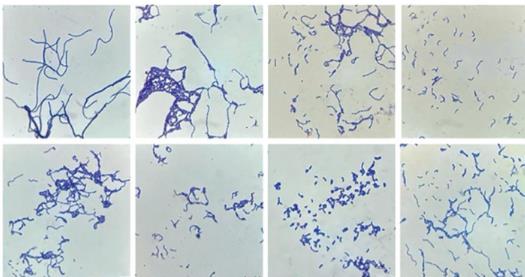 高產(chǎn)蛋白酶乳酸桿菌高效篩選方法、生長曲線測(cè)定及耐受能力分析（一）