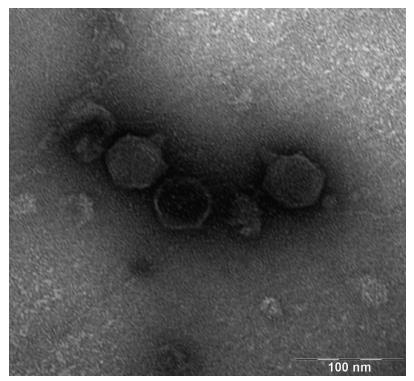 原生動物而非噬菌體主導(dǎo)對細菌的長期下行調(diào)控（二）