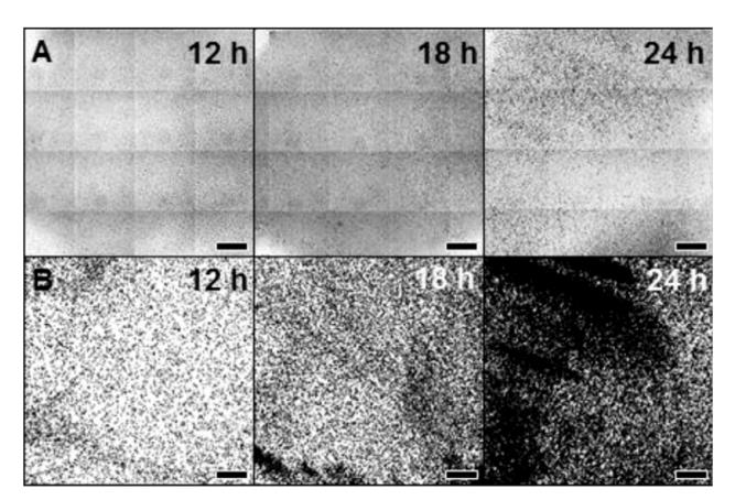 全自動微生物生長曲線分析儀應用：黃芩素與殼聚糖抑制酵母生物膜研究（一）